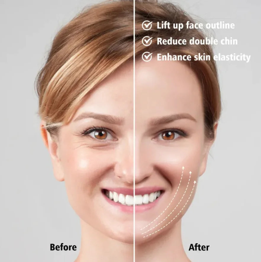 Before and after comparison of facial treatment effects on a woman's face.